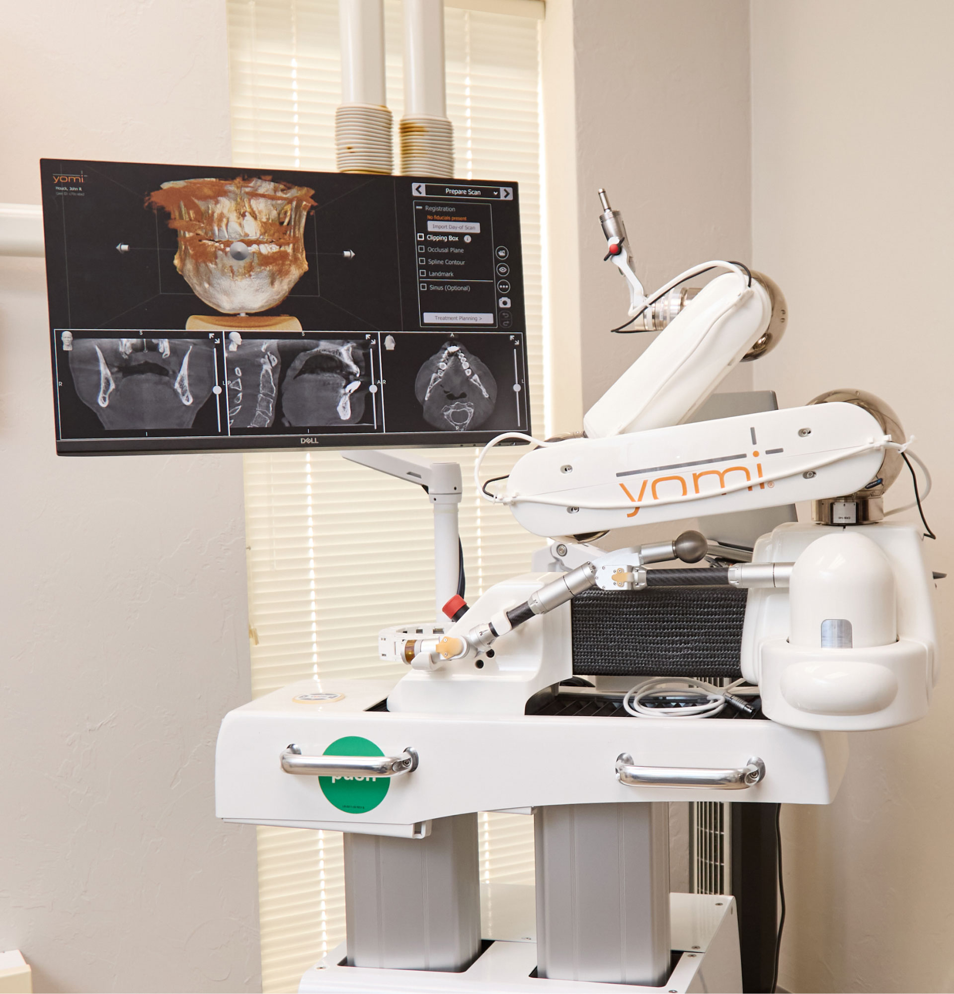 yomi robotic implant machine