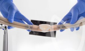 Dental anesthesia for restorative work.